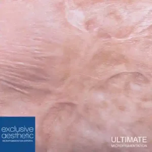 How Micropigmentation Reduces the Appearance of Burn Scars: Enhancing Skin Recovery, reducing burn scars, and promoting skin recovery.